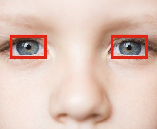Vierkante ogen en oogklachten